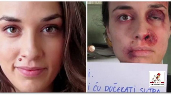 Mia Hujic “злоупотребуваната” девојка од видео клипот што го запали светот! Видео