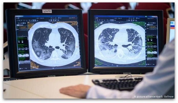 Еве како да ја исфрлите короната од организмот пред да биде доцна