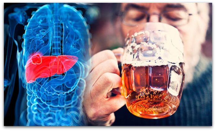 Симптоми кои укажуваат дека црниот дроб е оштетен од прекумерно внесување алкохол