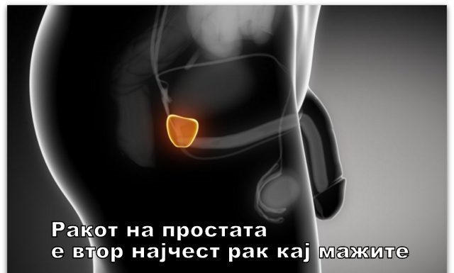 Простата и ејакулација | Откриено е како честата ејакулација влијае на развојот на ракот на простата