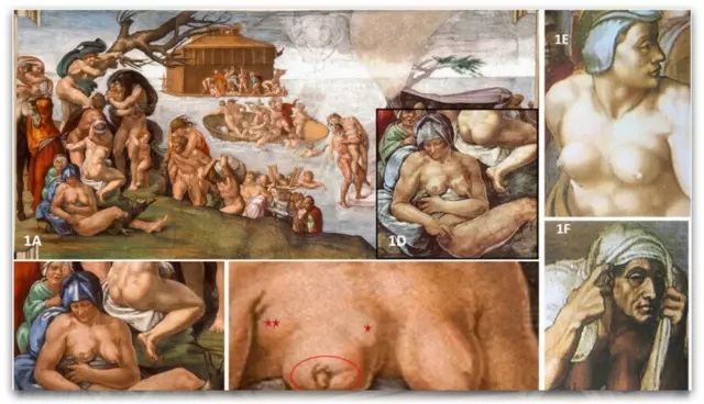 Дали Michelangelo сокрил детал од злобната смртоносна болест.