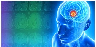 Научниците тестираат капки за нос кои директно се насочени кон еден од најсмртоносните тумори